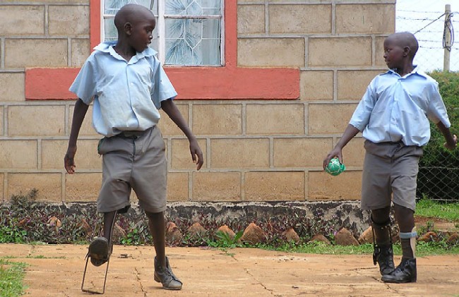  Mit Prothesen und Orthesen wird den Kindern die Möglichkeit gegeben, wieder am Alltagsleben teilzuhaben und auch wieder Fußball zu spielen